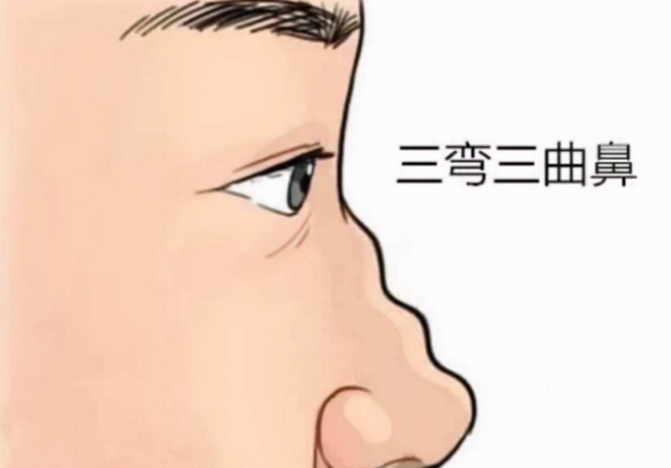 八字眉是什么样子的(俗语“男怕八字眉,女怕弯鼻眉,)插图3 八字眉是什么样子的(俗语“男怕八字眉,女怕弯鼻眉,)